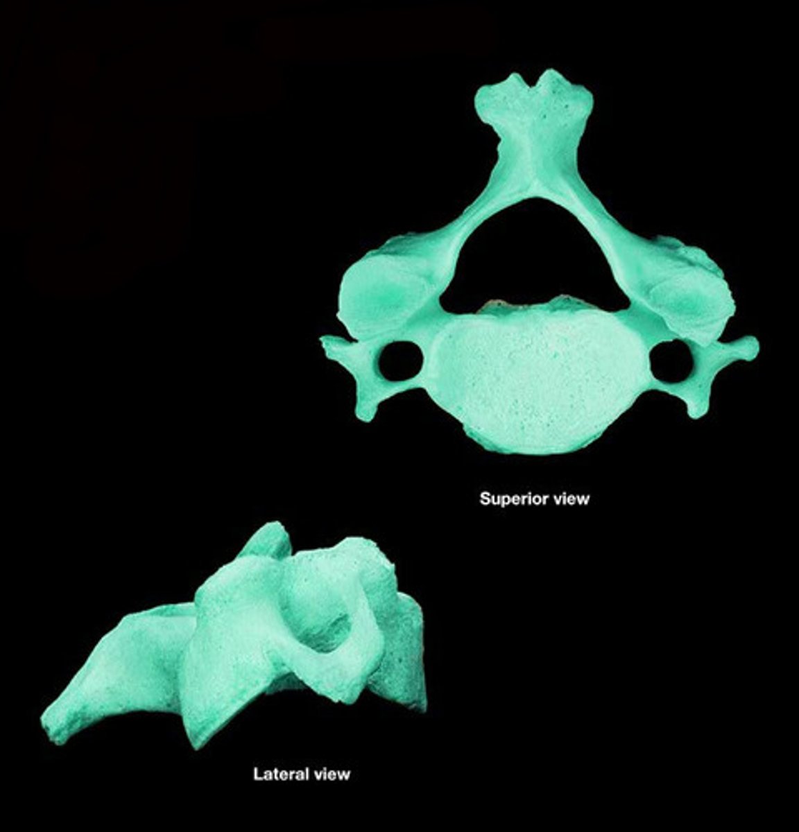 <p>Vertebra that are characterized with uncinate processes and transverse foramen.</p>