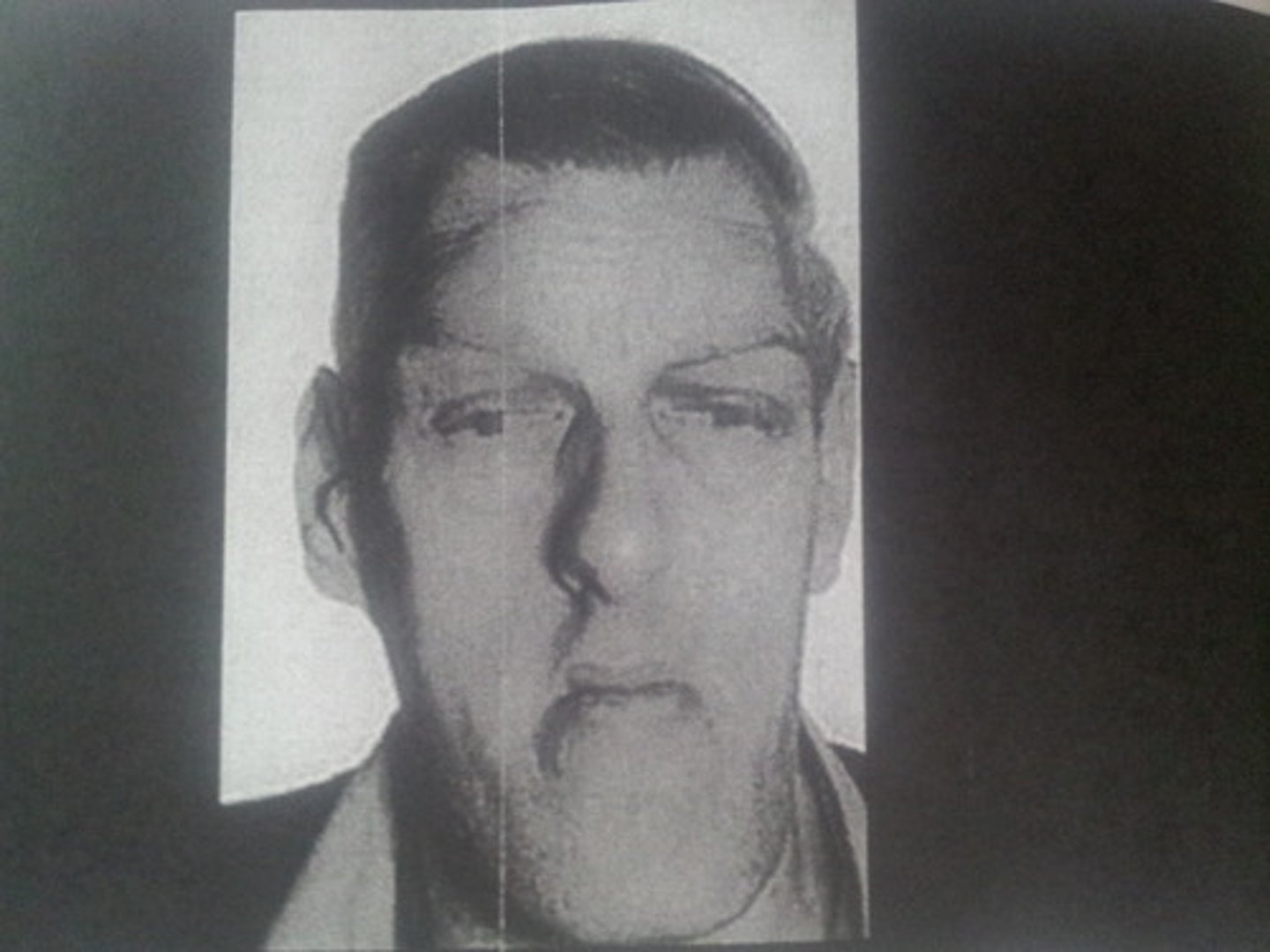 <p>elongated head</p><p>bony prominent features</p><p>enlargement of soft tissue</p><p>coarse facial features</p>