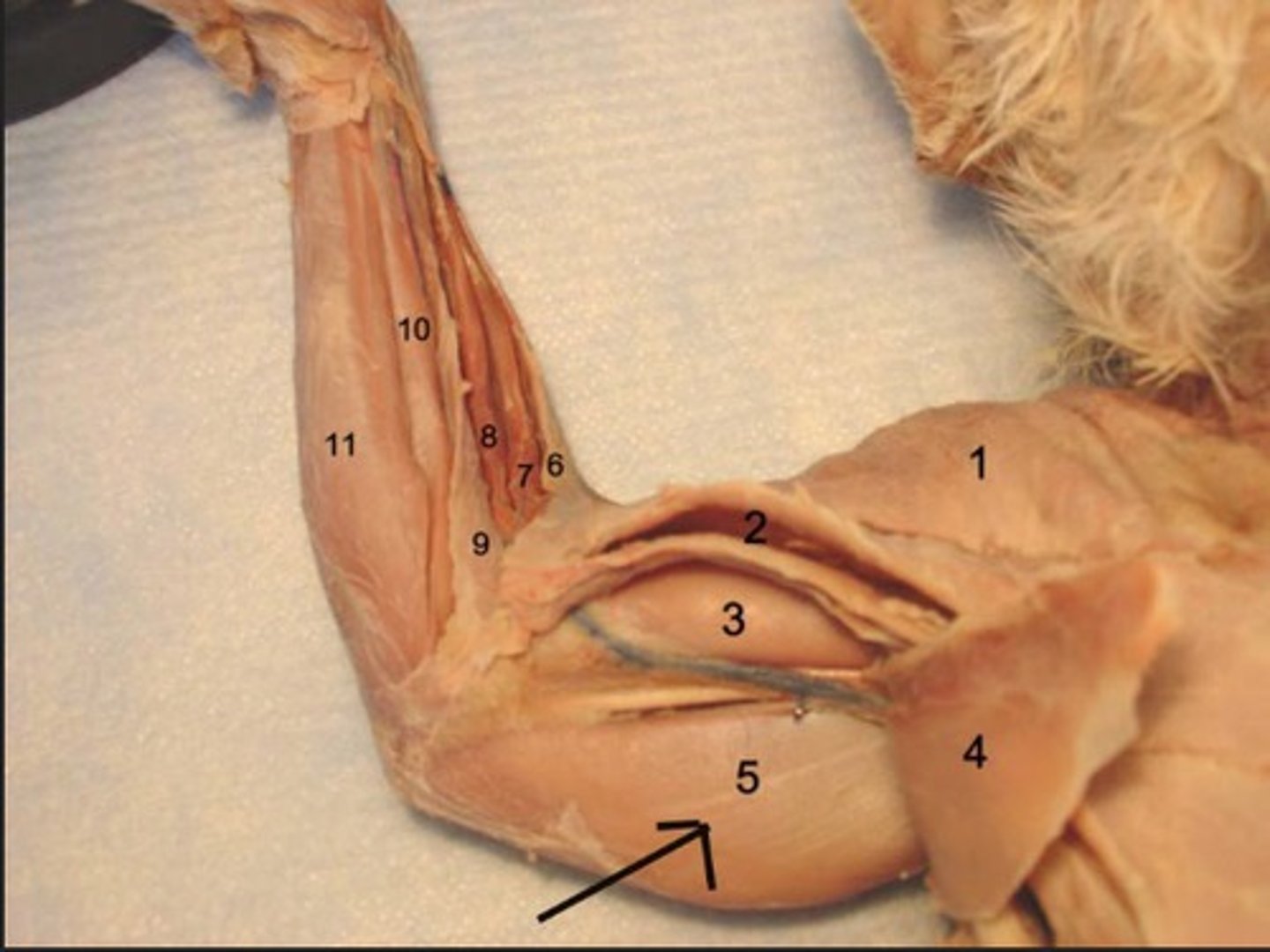 <p>What muscle is this?</p><p>Origin?</p><p>Insertion?</p><p>Action?</p><p>Nerve?</p>