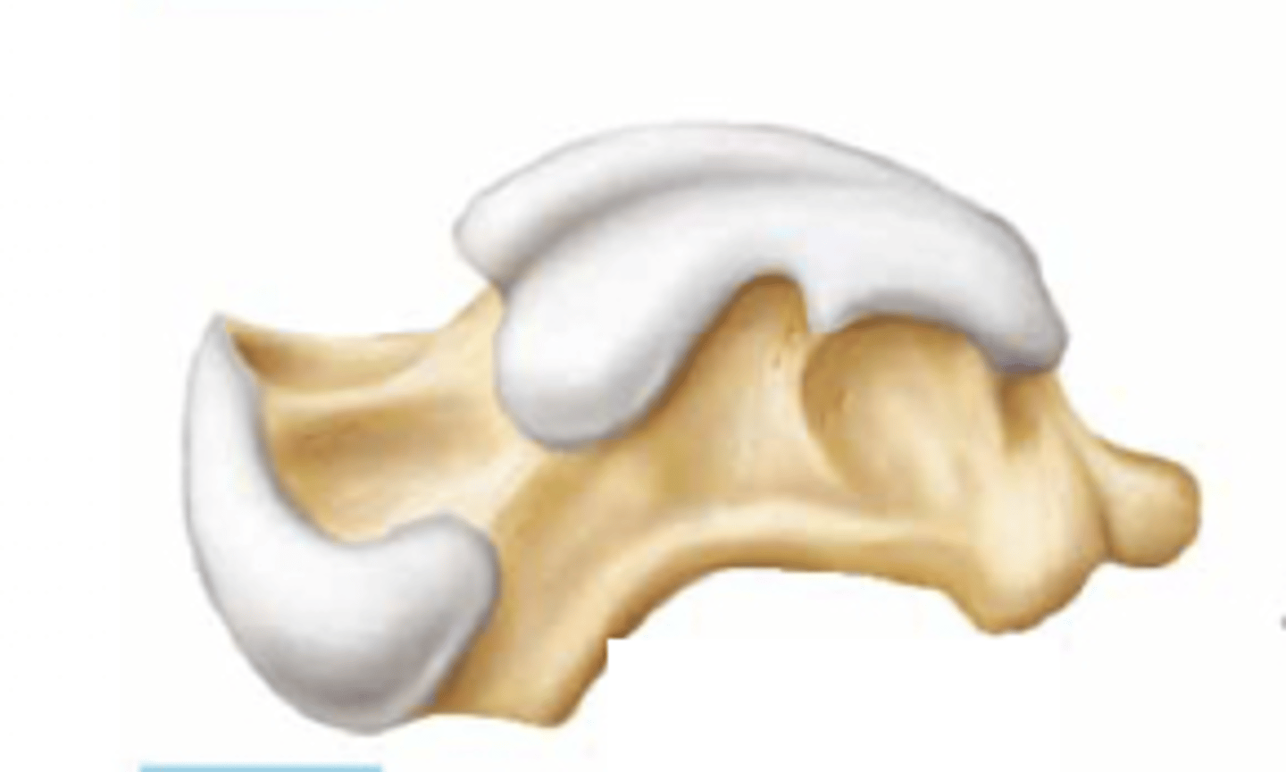 <p>What kind of bone is this?</p>