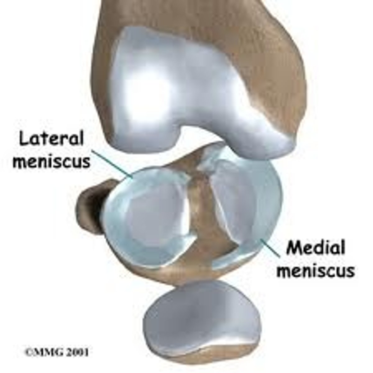<p>- C-shaped fibrocartilaginous pads found between femoral and tibial condyles</p><p>- provides shock absorption and stability to the knee joint</p>