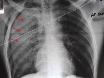 <p>diagnosis</p>