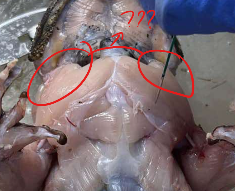 <p>a triangularly-shaped muscle that lies at the anterior border of the shoulder</p>
