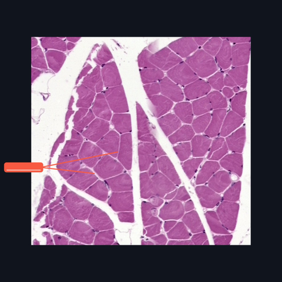 <p>Identify the structure</p>