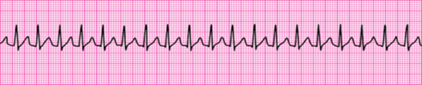 <p>Vagal maneuvers</p>