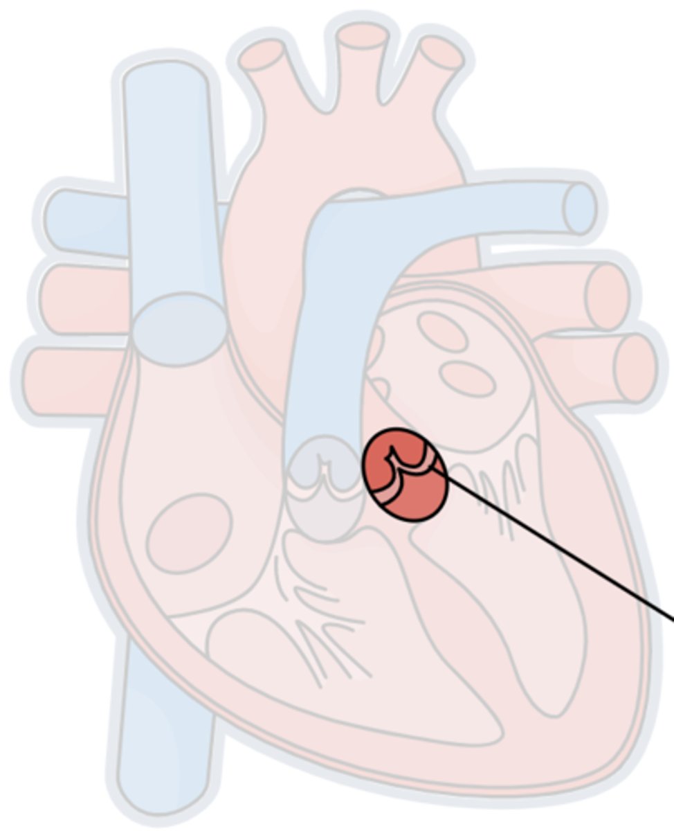 <p>Btwn the left ventricle &amp; aorta</p>