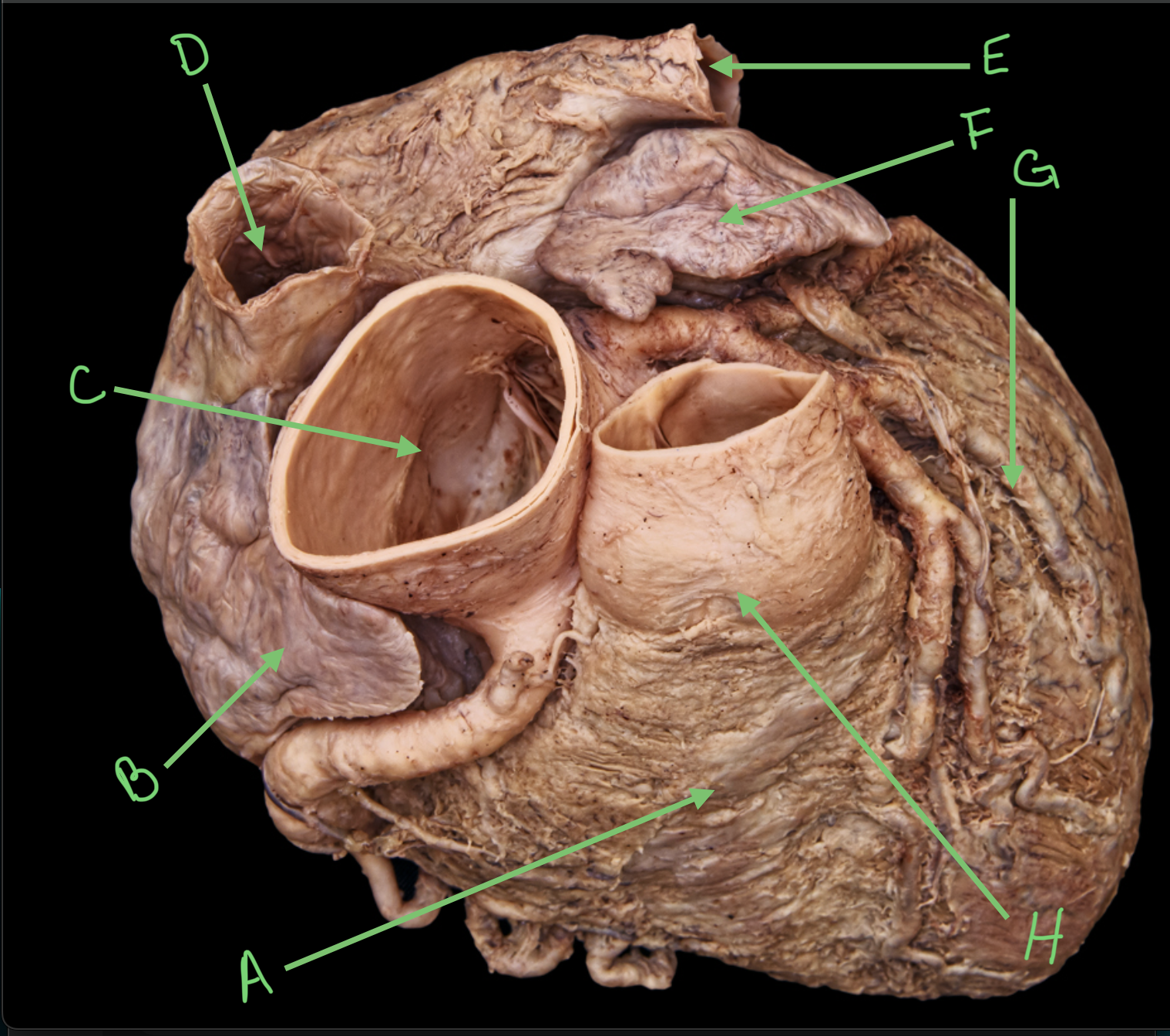 term image