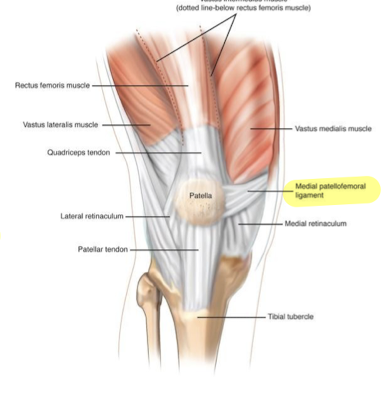 <p>Medial patellofemoral ligament (MPFL) </p>