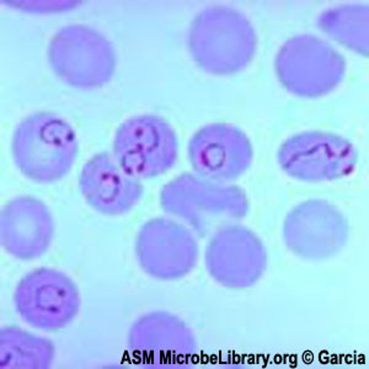 <p>causes malaria;</p><p>parasite that causes malaria</p>