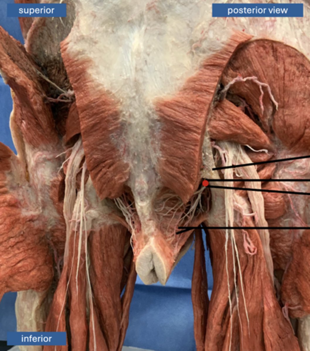<p>artery</p>
