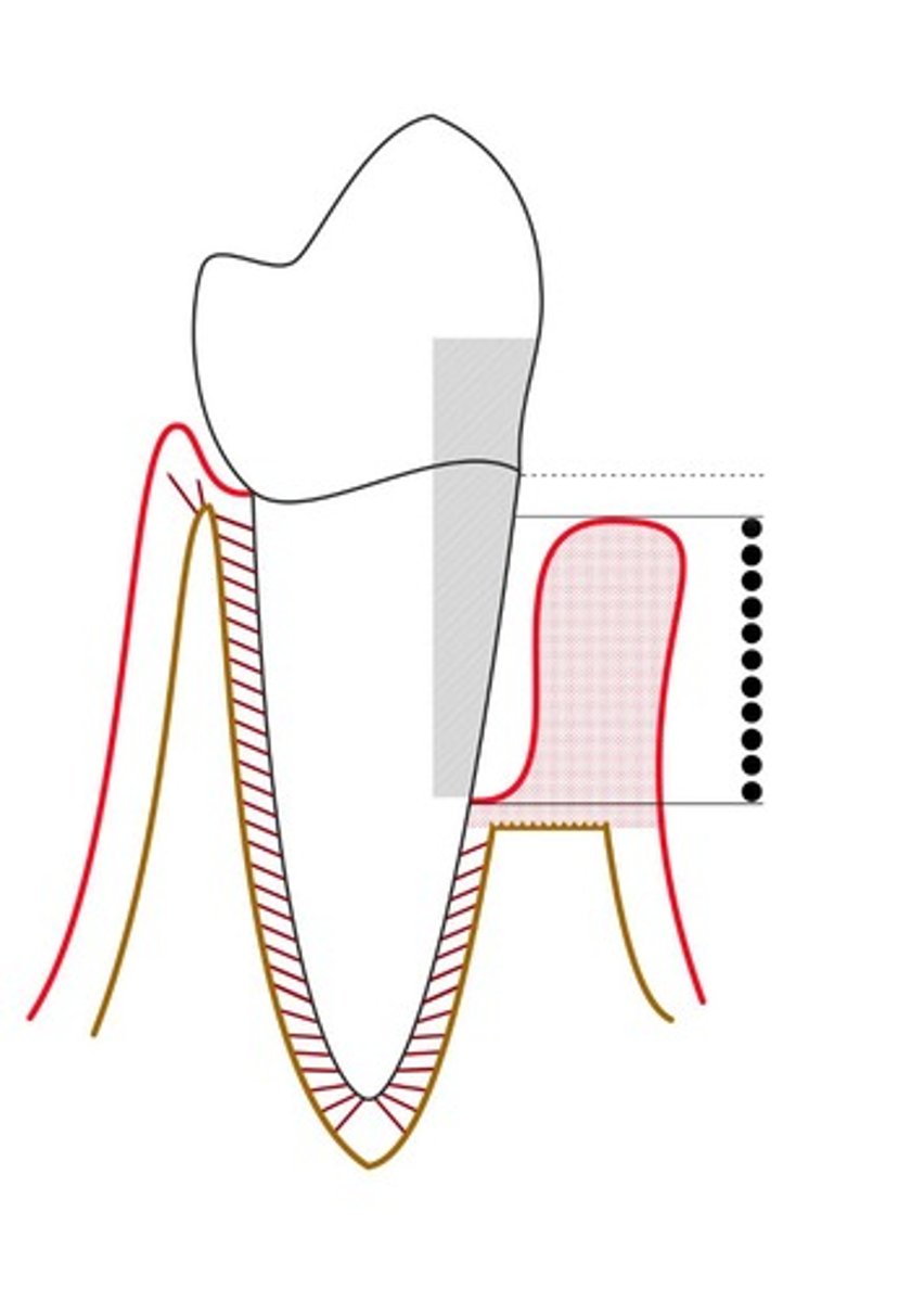 <p>Clinical indicators of periodontal disease presence.</p>