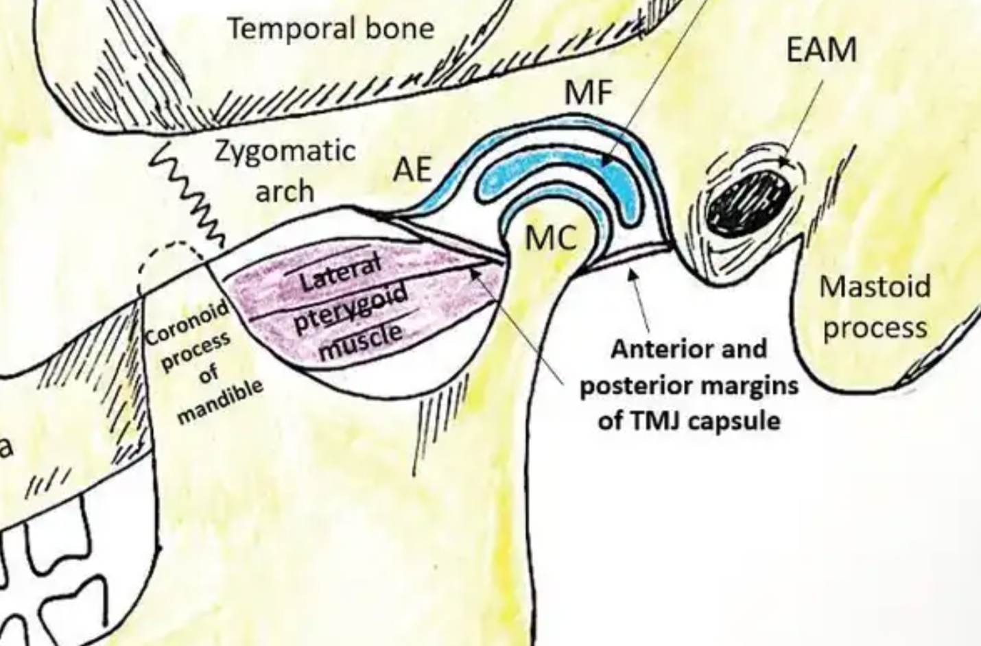 <p>False, max anterior movement <strong>before </strong> max translation of condyle</p>