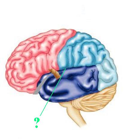<p><span><span>Identify the indicated groove of the brain</span></span></p>