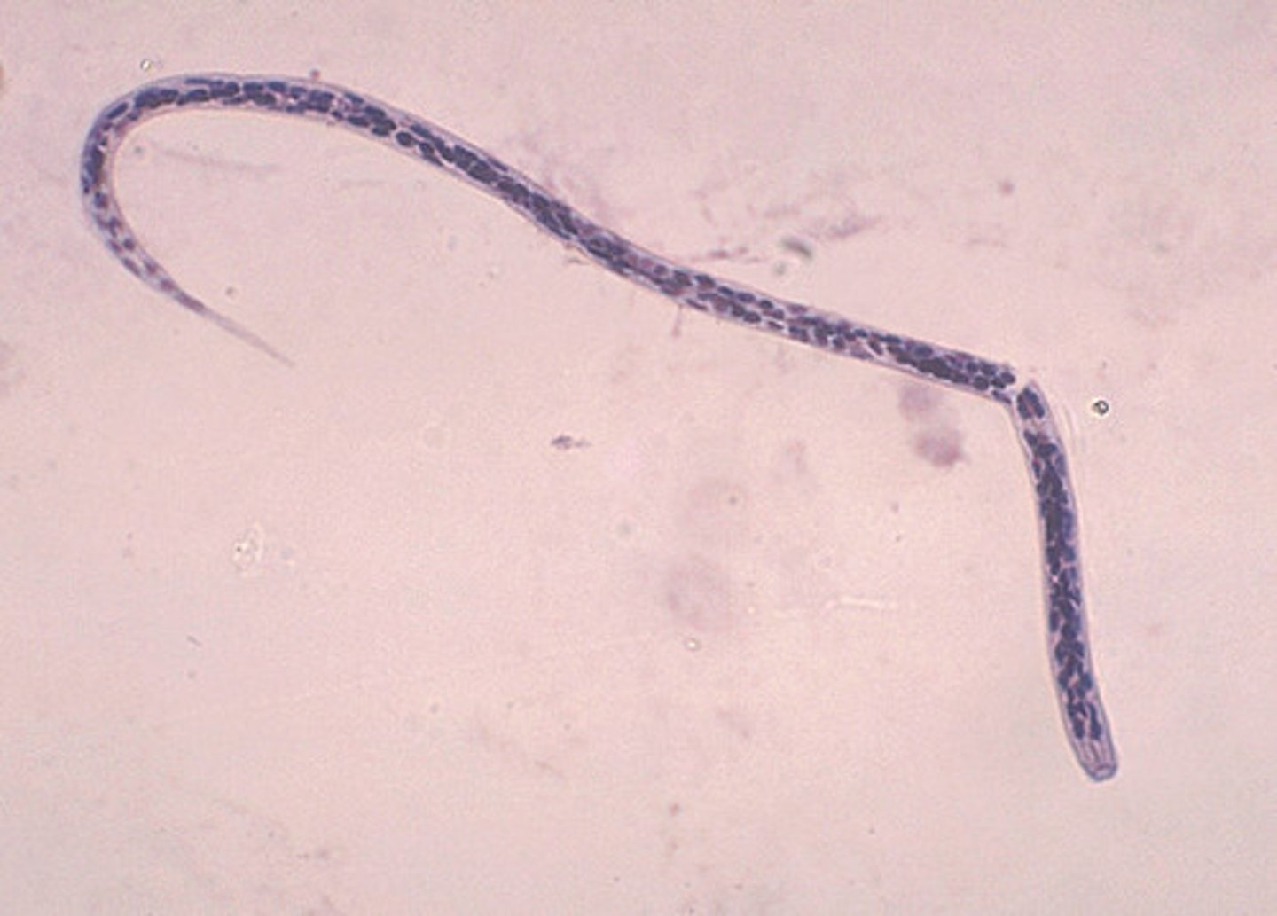 <p>No sheath</p><p>Nuclei to the tip of the tail</p>