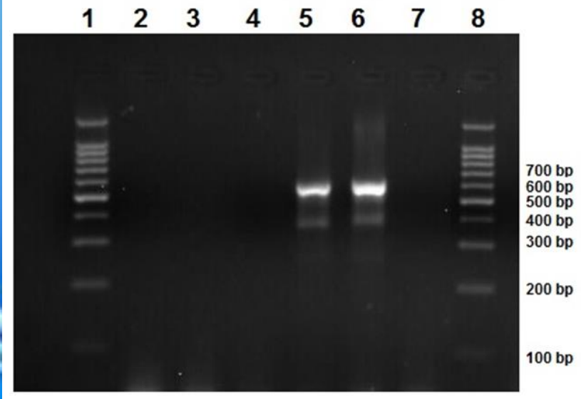 <p>Detection of parasitic DNA using PCR-based assays</p>