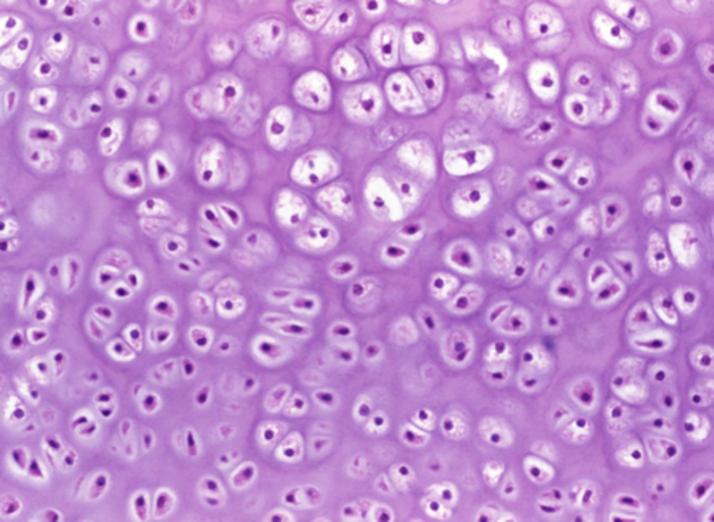 <p>Which feature in the previous image is responsible for cushioning the body from mechanical impact?</p><p>Flexible extracellular matrix with no blood or nerve supply</p><p>Basement membrane supporting the cells' basolateral surface</p><p>Rigid extracellular matrix rich in calcium</p><p>Densely packed actin and myosin filaments</p>