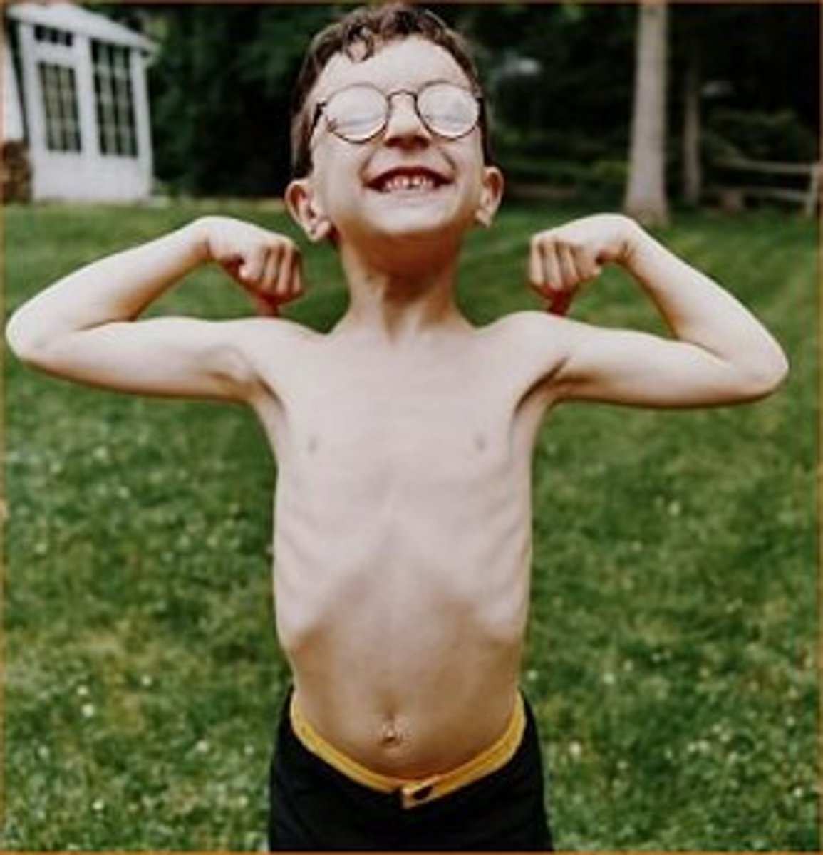 <p>/ˈskrɔː.ni/ (adj)<br>(of a person's or animal's body) very thin because not fed enough, so that you can see the shape of the bones under the skin:</p>