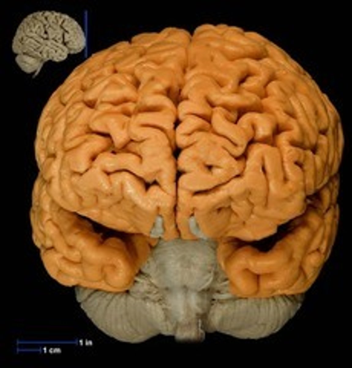 <p>"the whole brain;" The largest division of the brain. It is divided into two hemispheres, each of which is divided into four lobes.</p>