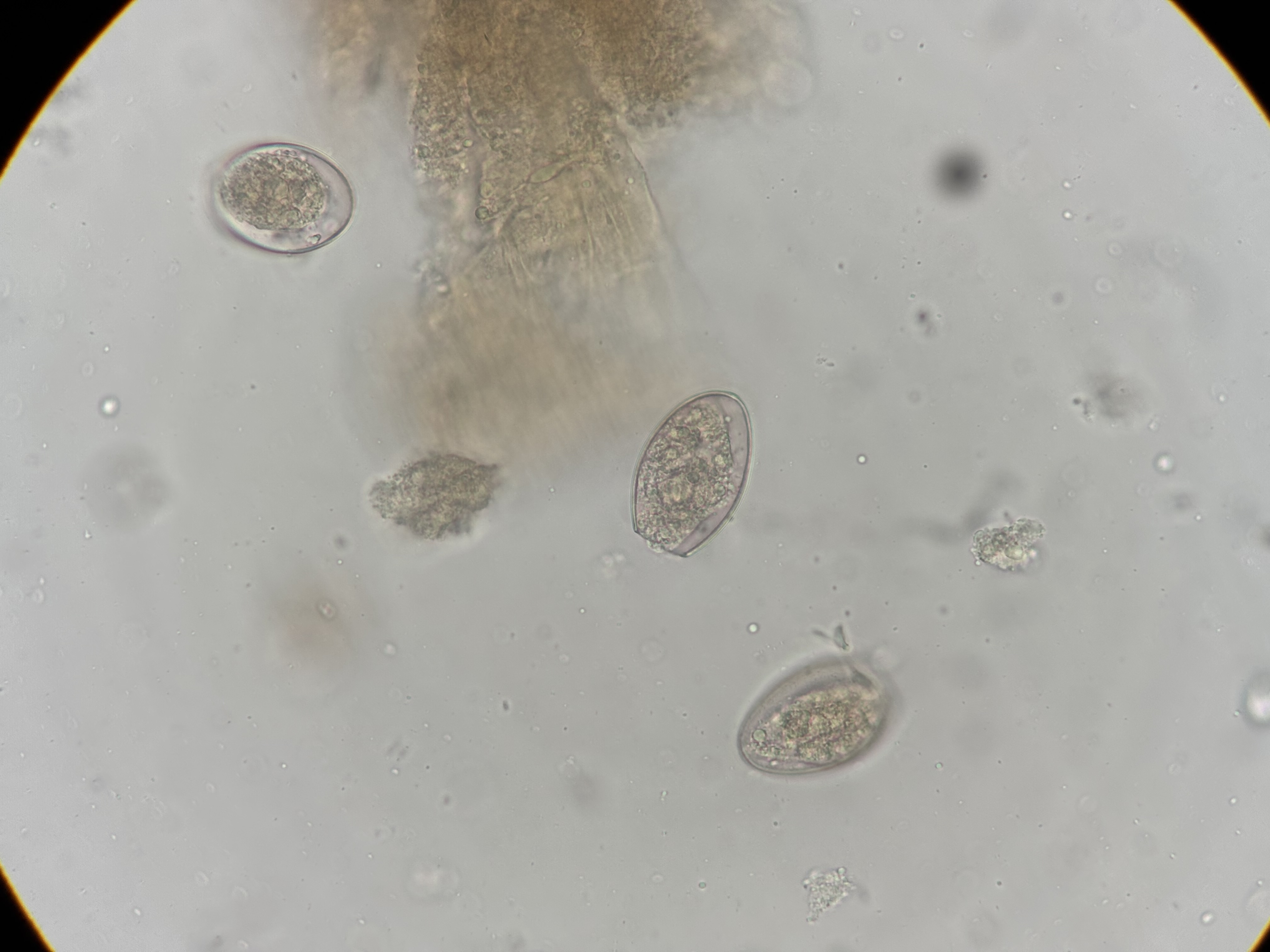 <p>Diphyllobothrium latum</p>