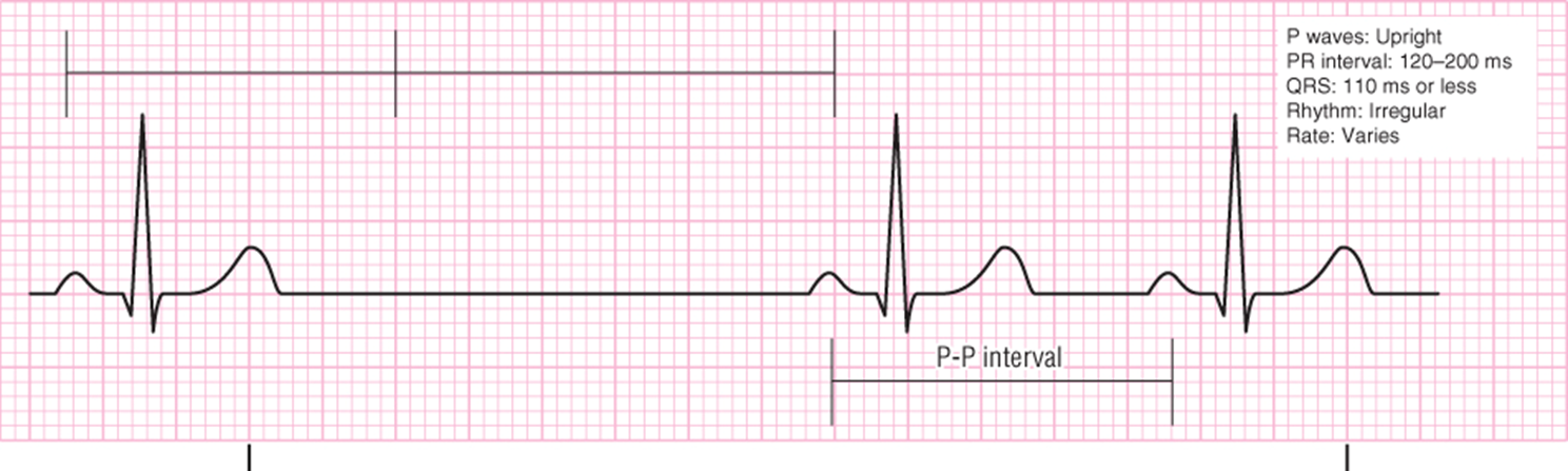 Treatment based on the overall HR and tolerance