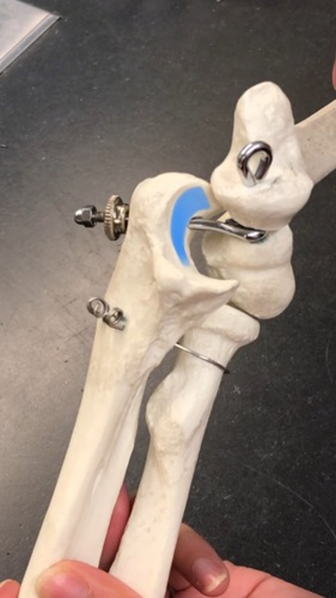 <p>"where ice cream goes into"; depression below olecranon</p>