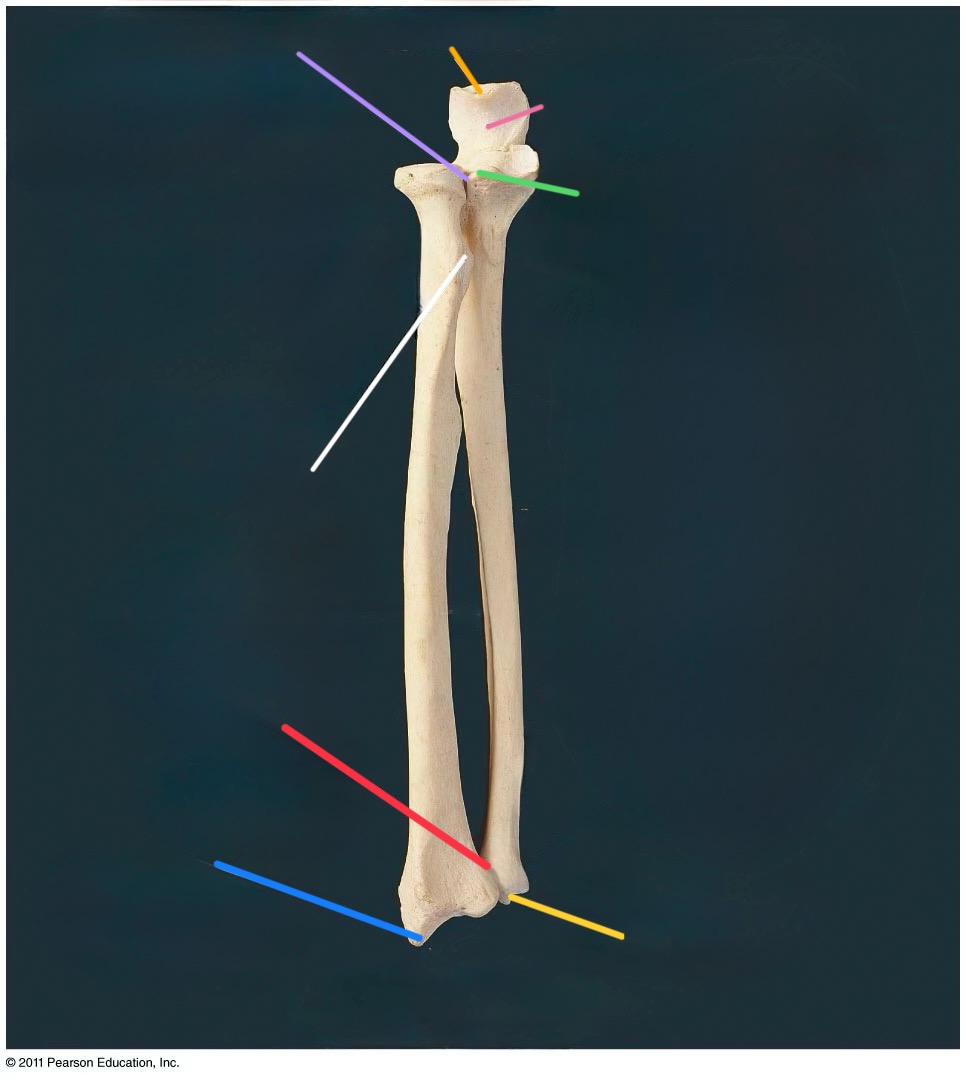 <p>pink line</p>