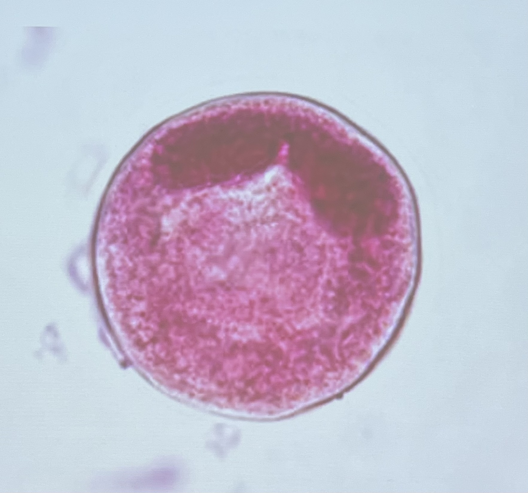 <ul><li><p><mark data-color="yellow" style="background-color: yellow; color: inherit">Trophozoite</mark>: large oval, bean shaped nucleus, cilia</p></li><li><p><mark data-color="yellow" style="background-color: yellow; color: inherit">Cyst</mark>: circular, bean shaped nucleus, no cilia </p></li></ul><p></p>