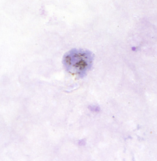 <p>Dr. Vicente Y. Belizario Jr.</p>