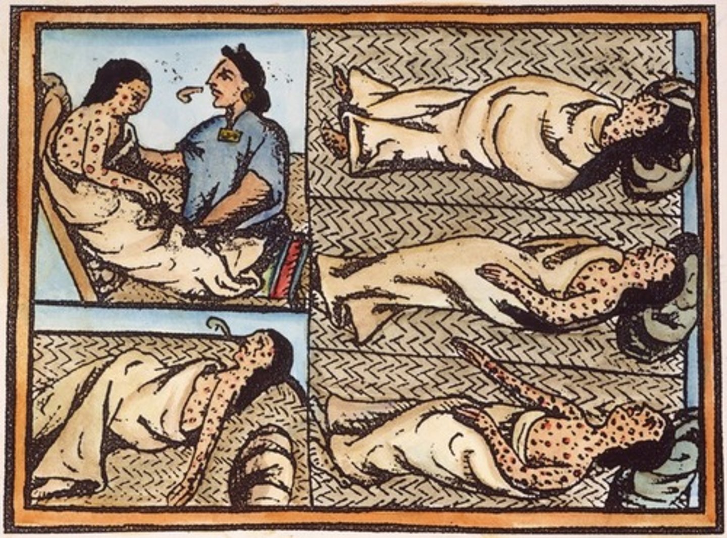 <p>A highly contagious viral disease characterized by fever, weakness, and skin eruption with pustules that form scabs; responsible for killing millions of Native Americans.</p>