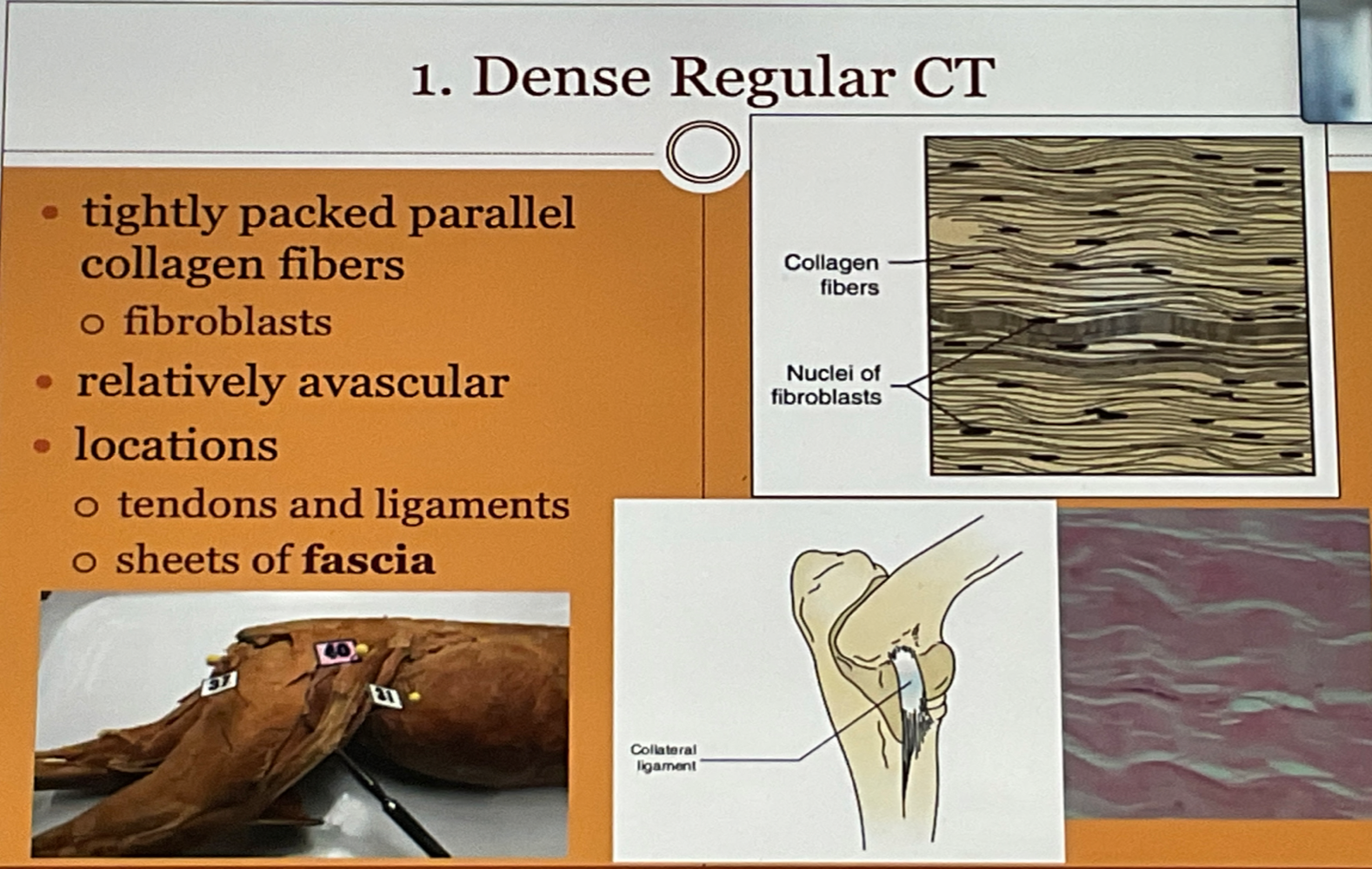 Dense Regular CT 