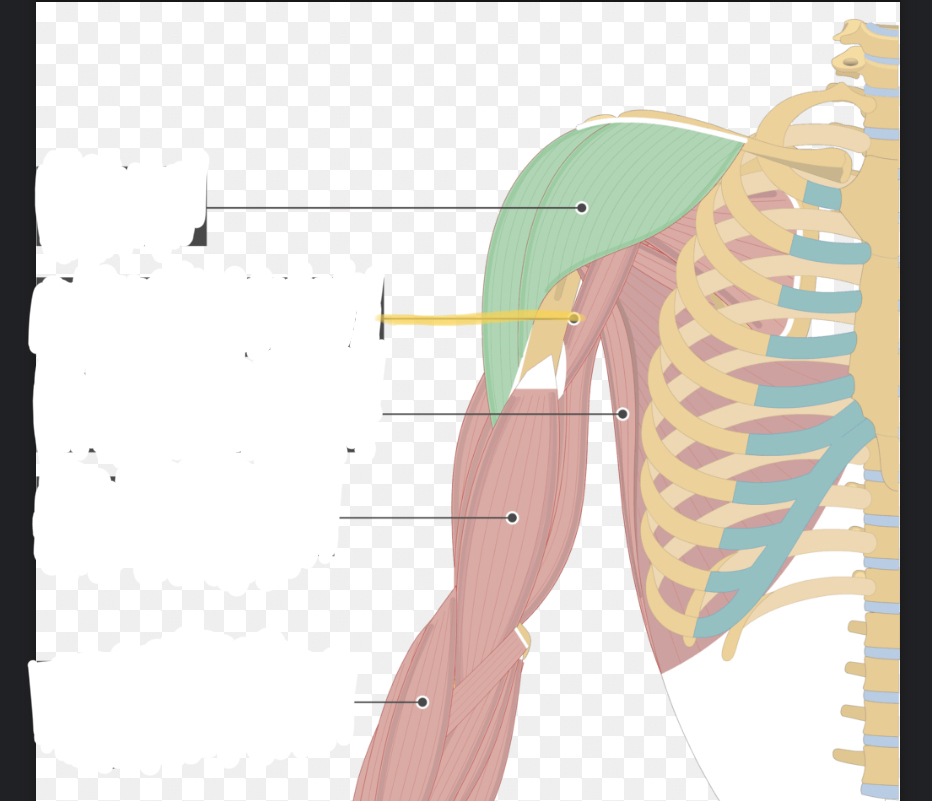 <p>Identify the highlighted muscle( highlighted line)</p>