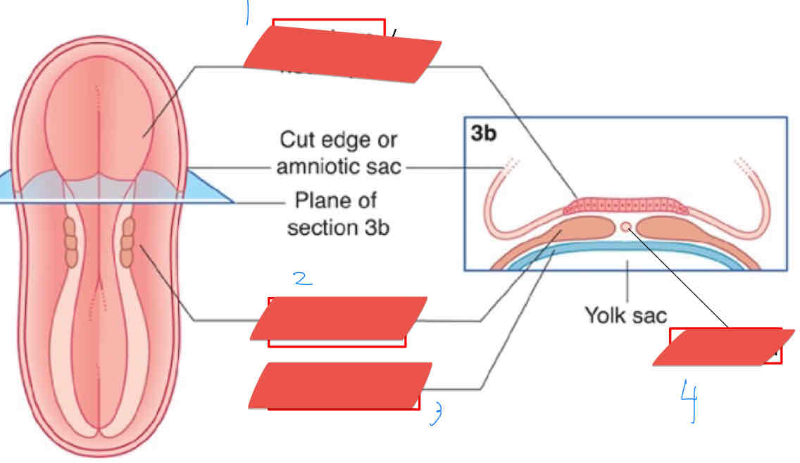 <p>What structure is being show a number 1?</p>