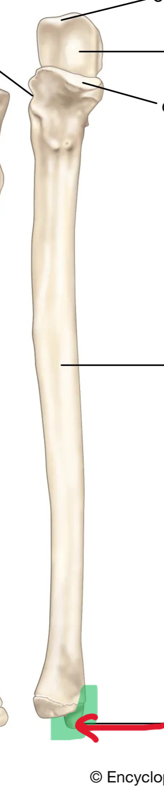 <p>What part of the ulna is this?</p>