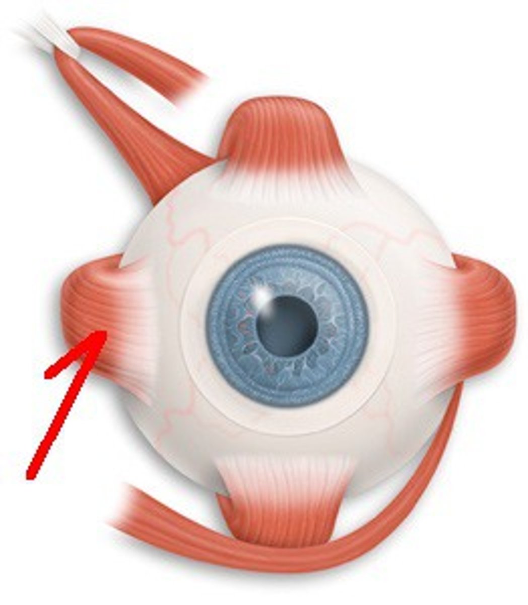 <p>What is this? (left eye)</p>