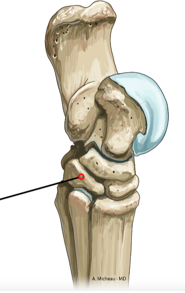 <p>Medial weight-bearing metatarsal; supports digit 2.</p>