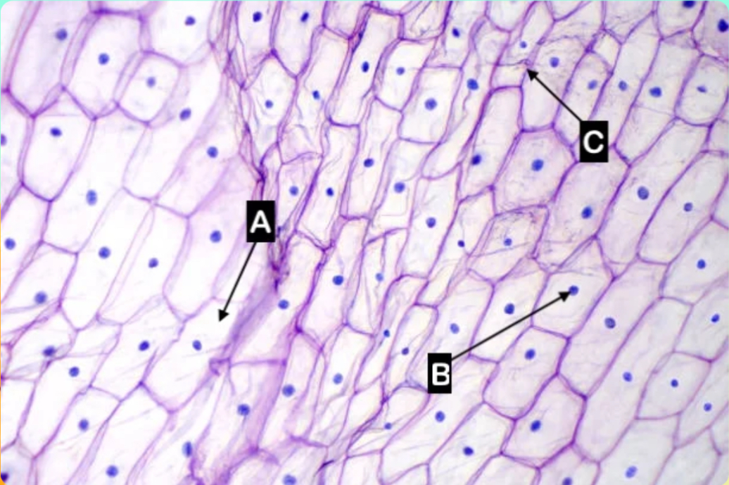 <p>Which letter is pointing to the cytoplasm of the cell?</p>