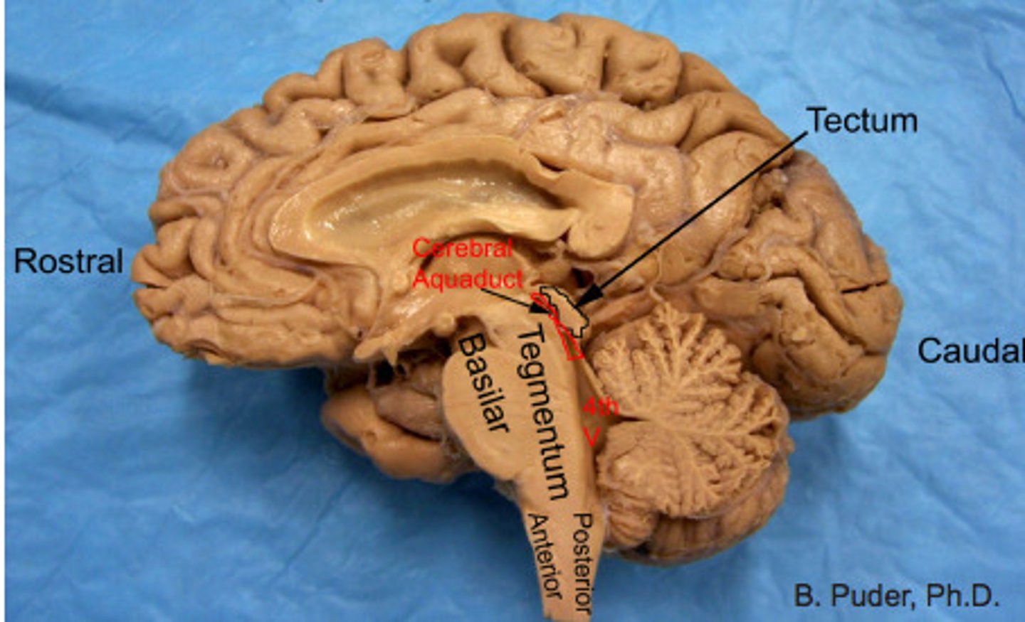 <p>- reticular formation</p><p>- periaqueductal gray</p><p>- substantia nigra</p><p>- ventral tegmental area (VTA)</p><p>- red nucleus</p><p>- cerebellar peduncles</p>