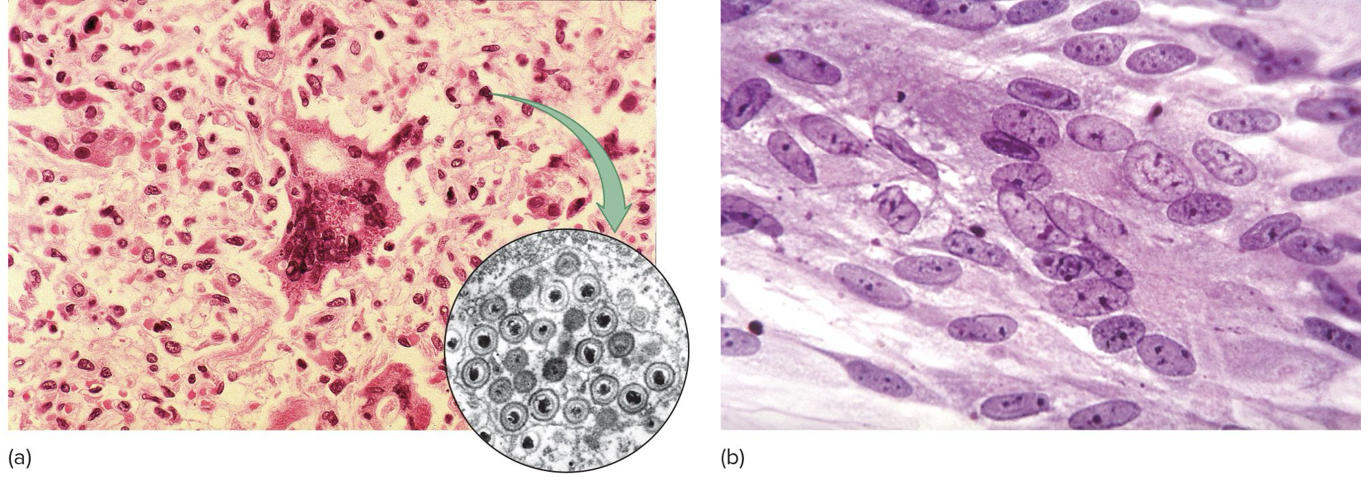 <ul><li><p>virus-induced damage to cells</p><ul><li><p>Changes in size and shape</p></li><li><p>Cytoplasmic and nuclear inclusion bodies</p></li><li><p>Cells fuse to form giant multi-nucleated cells (<strong>syncitia</strong>)</p></li><li><p>Cell lysis</p></li><li><p>Alter DNA</p></li><li><p>Transform cells into cancerous cells</p></li></ul></li></ul><p></p>
