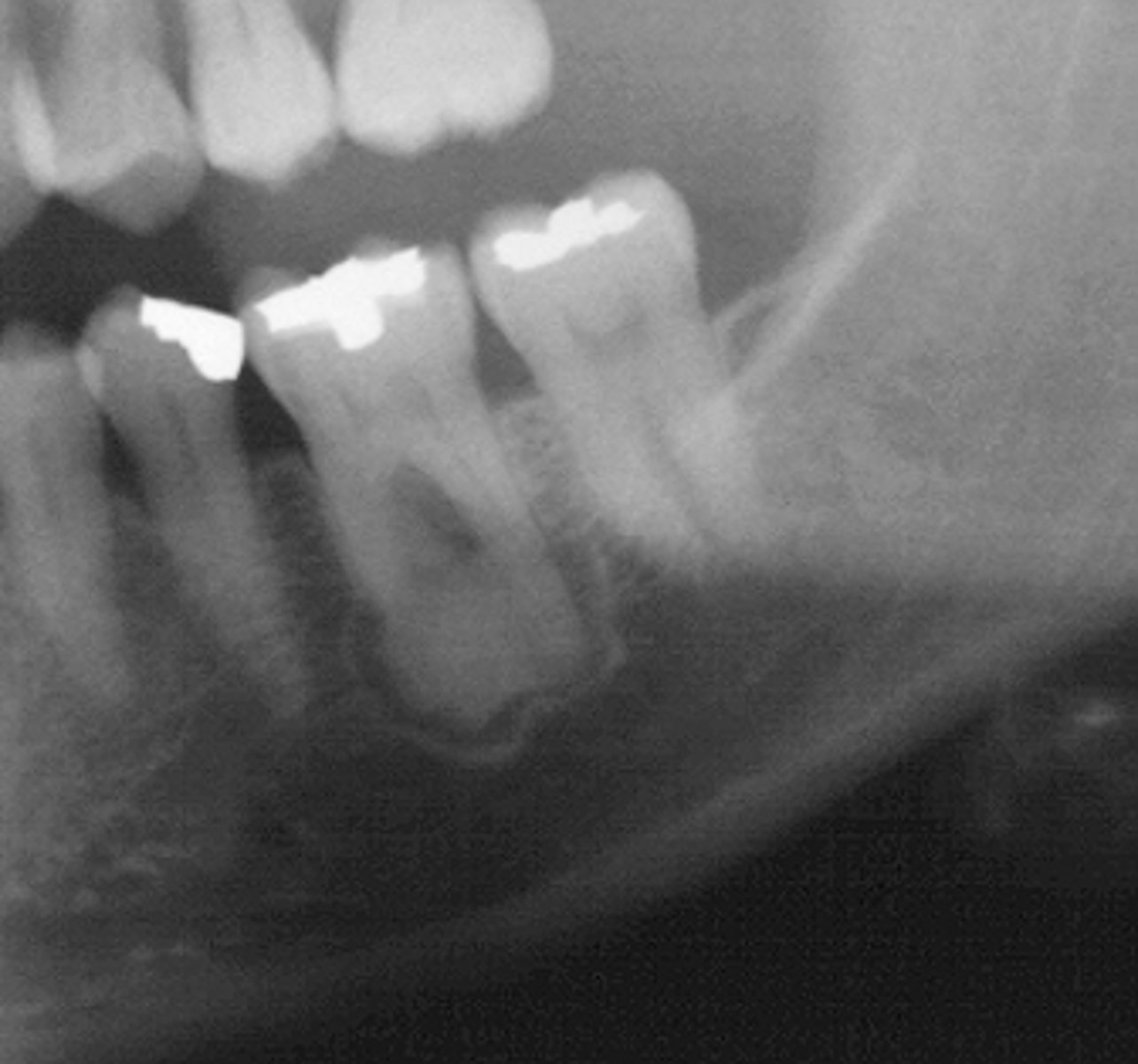 <p>ID the pathology:</p>