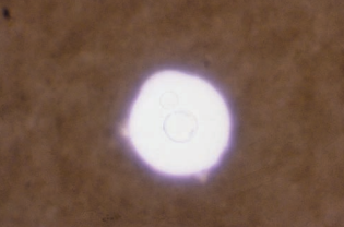 Figure 25: India ink preparation of C. neoformans