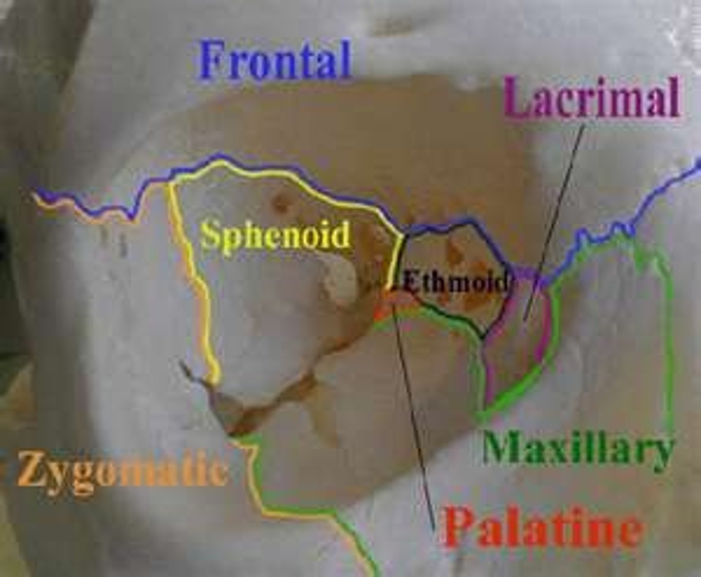 <p>frontal bone</p><p>maxilla</p><p>lacrimal bone</p><p>ethmoidal labyrinth</p><p>sphenoid</p><p>palatine bone</p><p>zygomatic bone</p>
