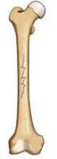 <p>what kind of fracture is this </p>
