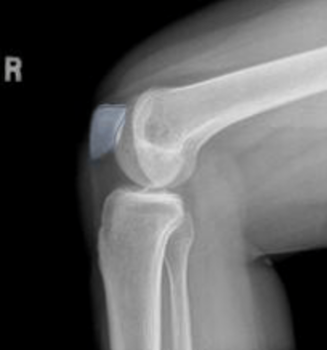 <p>What is outlined?</p>