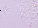 <ul><li><p>most frequently seen parasite in sediment</p></li><li><p>resembles WBCs or epithelial cell</p></li><li><p>STD so contaminant from genetilia</p></li></ul><p></p>