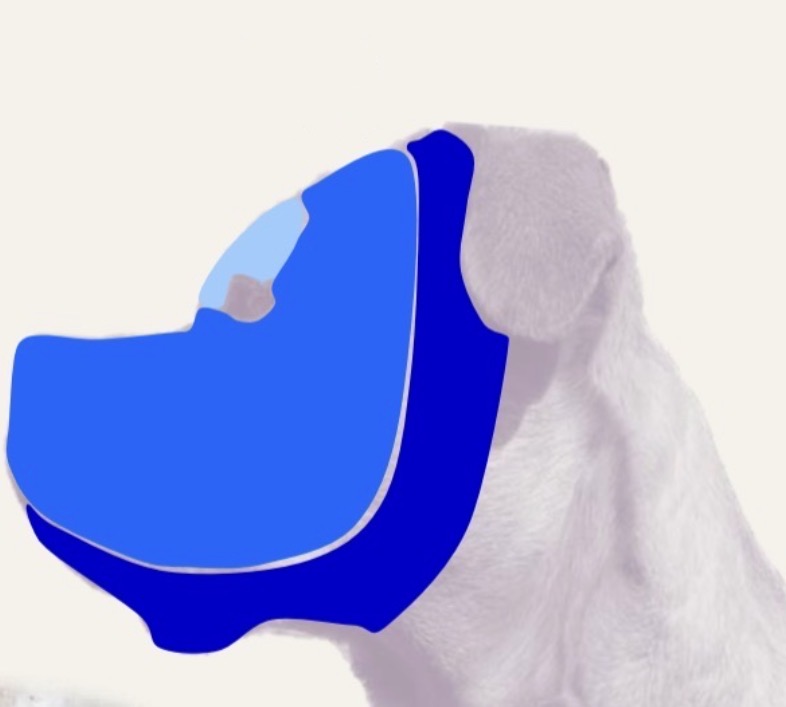 <p>What nerve innervates the area shaded in light blue?</p>