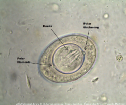 <p>What is the genus, species, and stage of this parasite?</p><p>•31-43μm</p><p>• Spherical/subspherical</p><p>• Oncosphere enclosed by inner envelope, with two polar thickenings from which arise 4-8 polar</p><p>filaments</p><p>• 6 (3 pairs) of hooklets</p>