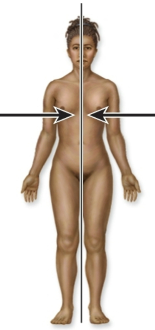 <p>Is this medial or lateral?</p>