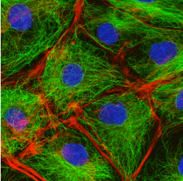 What part of the cell is labeled in blue?

a. nucleus 

b. ER 

c. mitochondria 

d. Golgi 

e. cytoskeleton