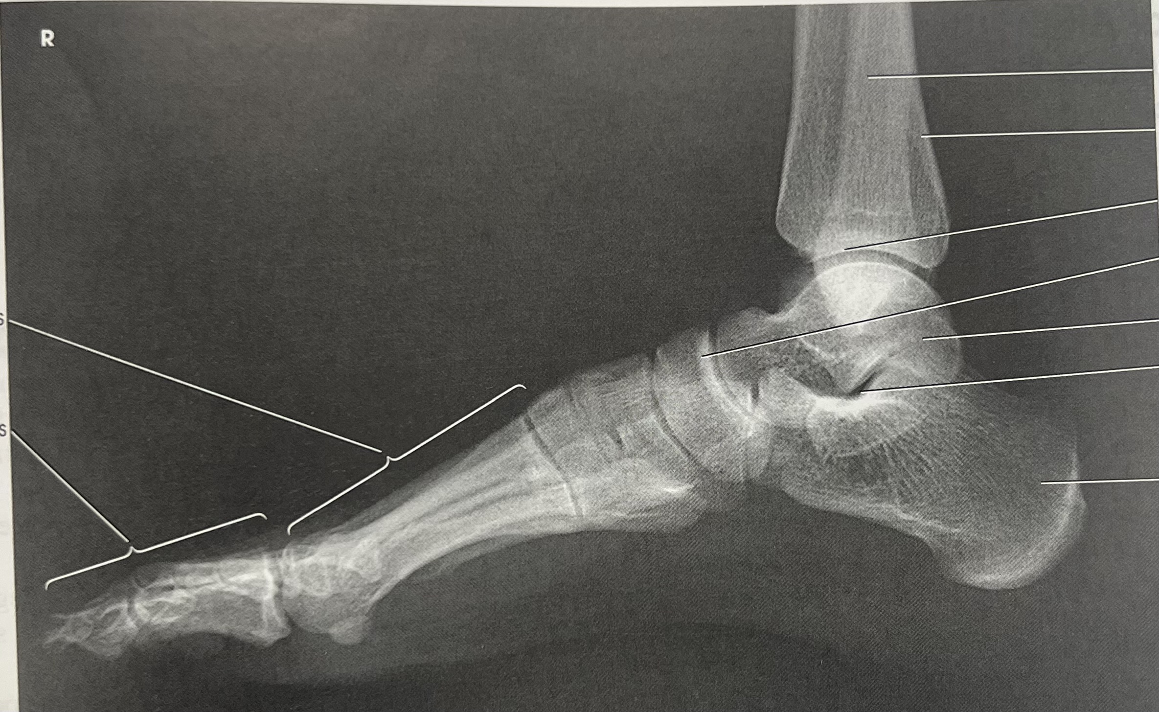 <p>identify the <strong>projection </strong>of the image </p>