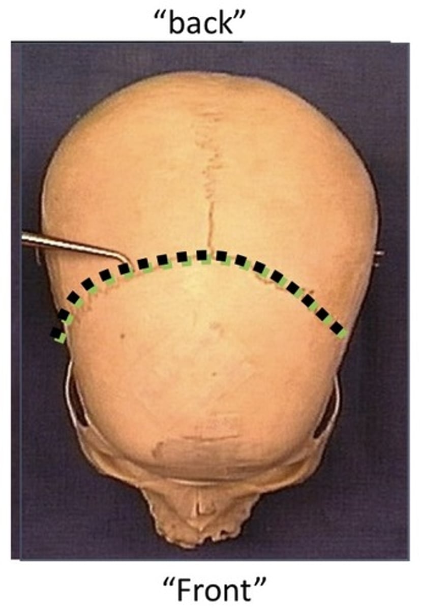 <p>1. Divides into a front and back</p><p>2. An anatomic cut from ear to ear</p><p>3. An anatomic cut through the both eyes</p><p>4. An anatomic cut through the mouth</p>